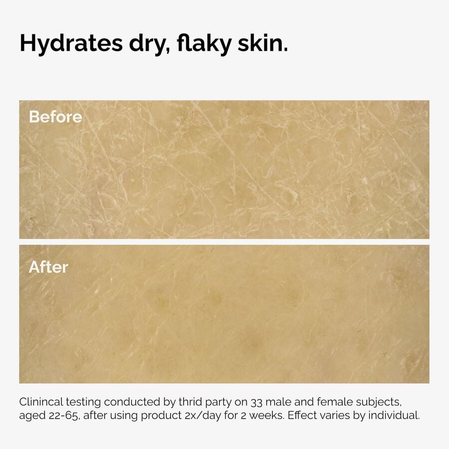 the-body-care-collection-n3 ord-natural-moisturizing-factors-inulin-body-before-after-graphic-02.jpg