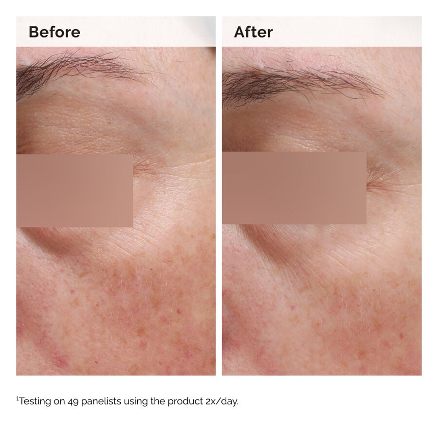 niacinamide-5-face-and-body-emulsion-p2 2024-08-23-ORD-Nia-5pct-Face-Body-B-A-Elasticity-Global-02-1x1.jpg