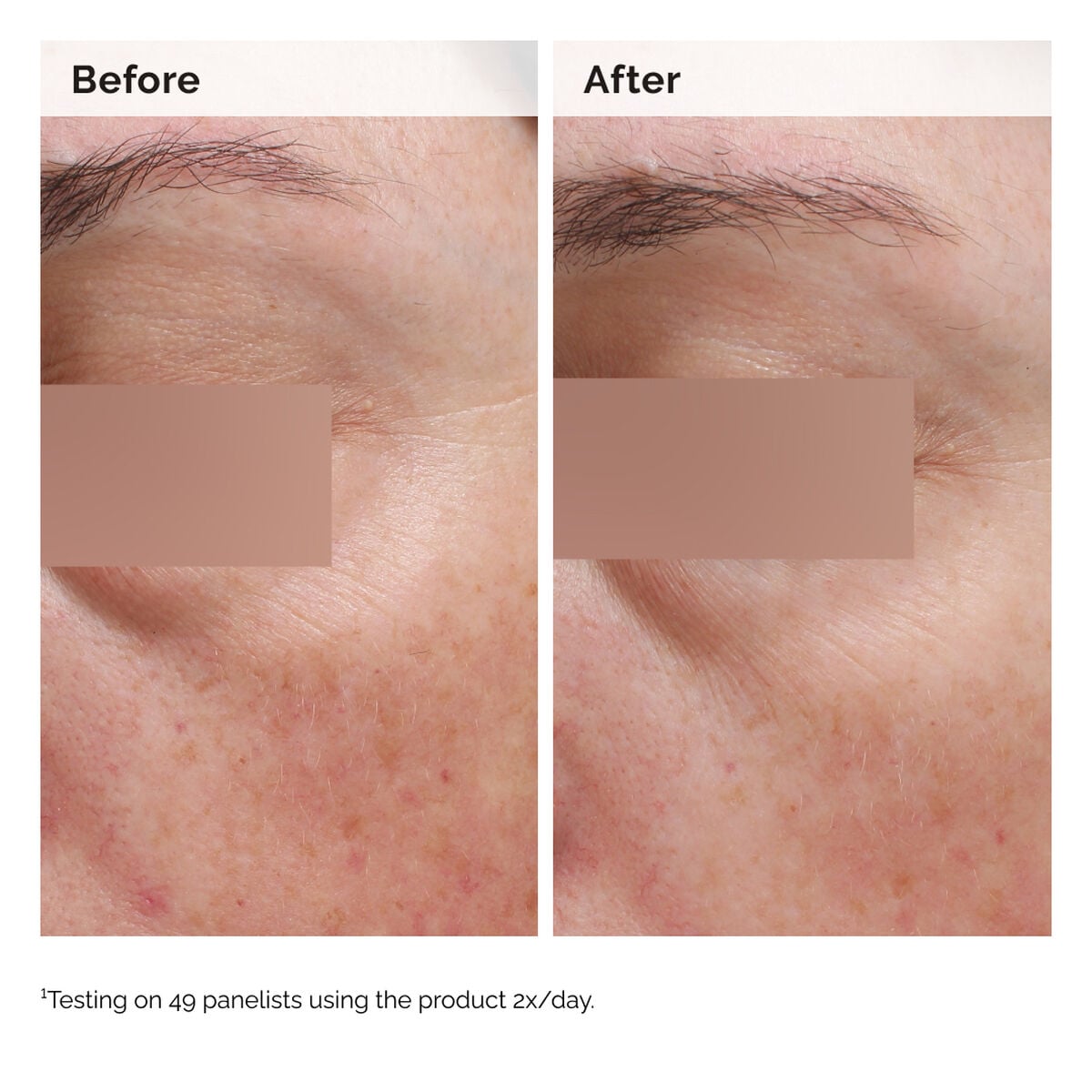 niacinamide-5-face-and-body-emulsion-p2 2024-08-23-ORD-Nia-5pct-Face-Body-B-A-Elasticity-Global-02-1x1.jpg