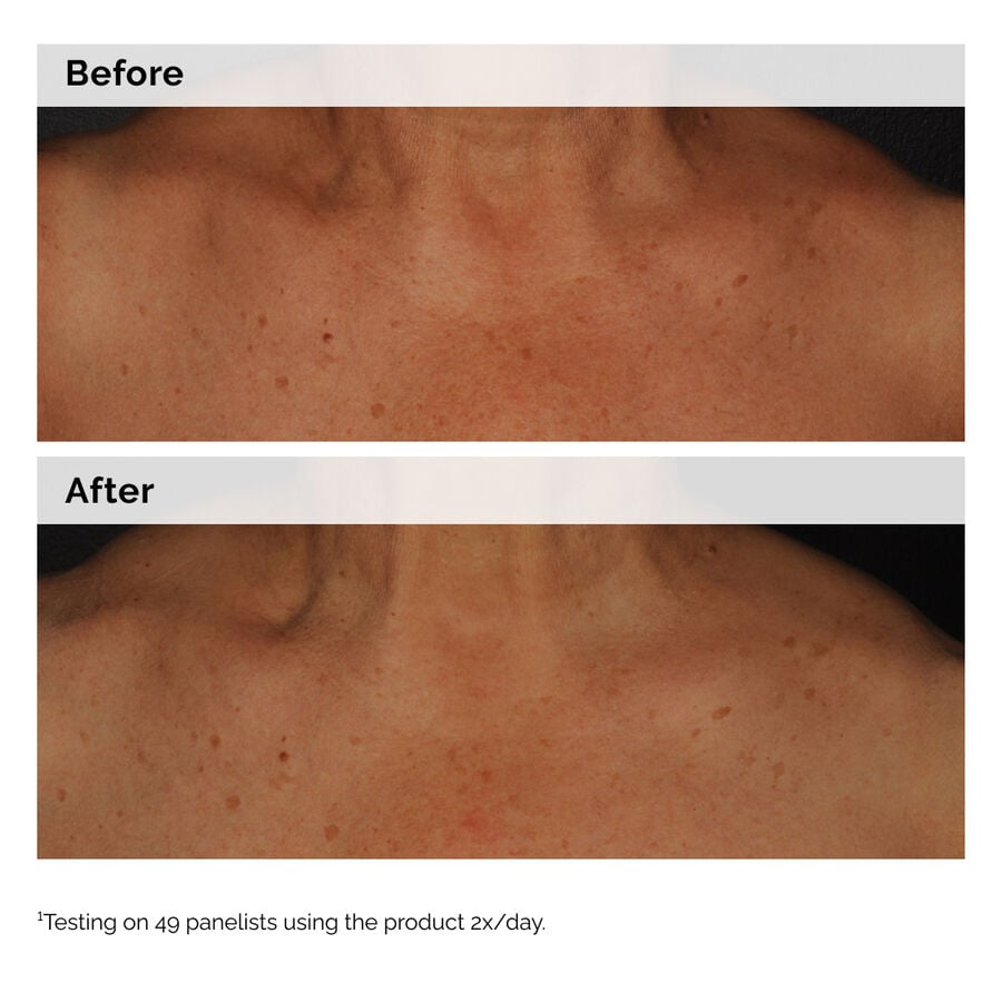 niacinamide-5-face-and-body-emulsion-p2 2024-08-23-ORD-Nia-5pct-Face-Body-B-A-Global-02-1x1.jpg