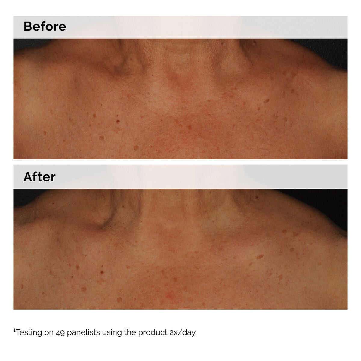 niacinamide-5-face-and-body-emulsion-p2 2024-08-23-ORD-Nia-5pct-Face-Body-B-A-Global-02-1x1.jpg