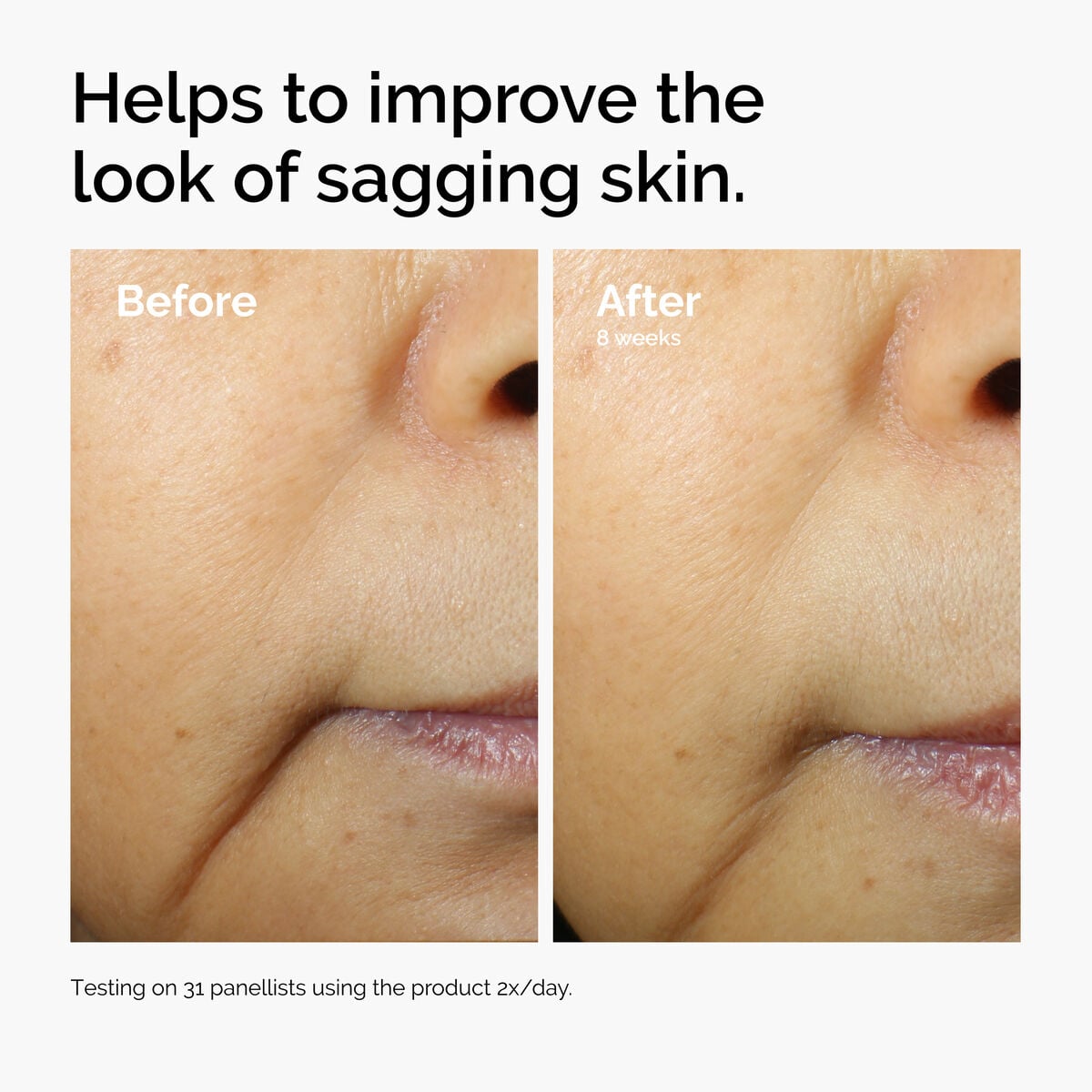 caffeine-3-escin-1-face-serum-a9 ord-caffeine-3pct-escin-1pct-face-serum-before-after-sagging.jpg