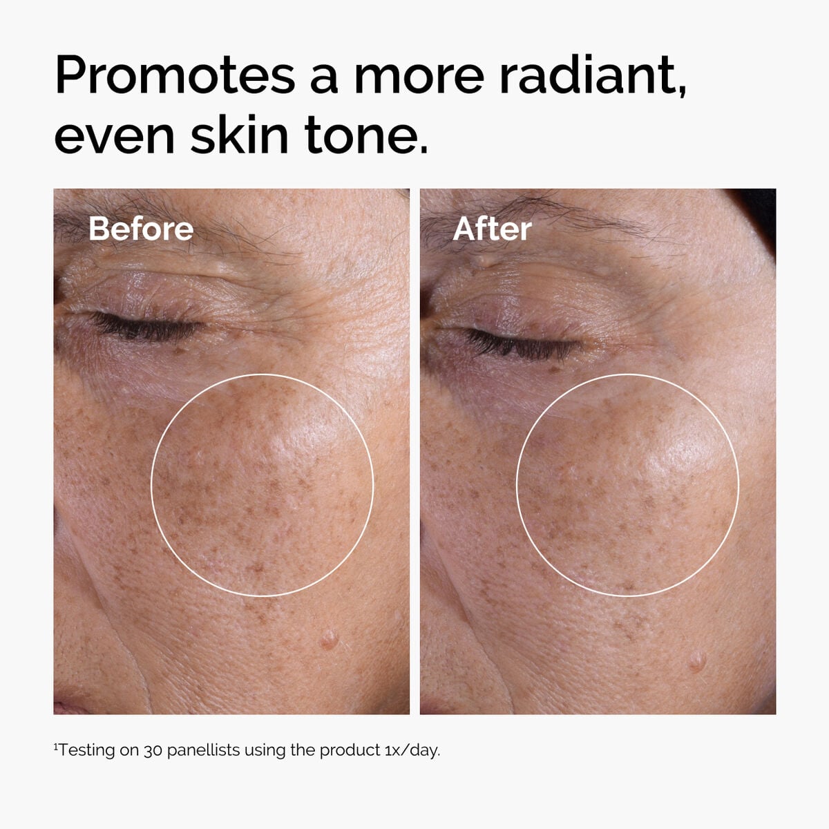 glycolic-acid-7-exfoliating-toner-j9 ord-glycolic-before-after-radiance.jpg