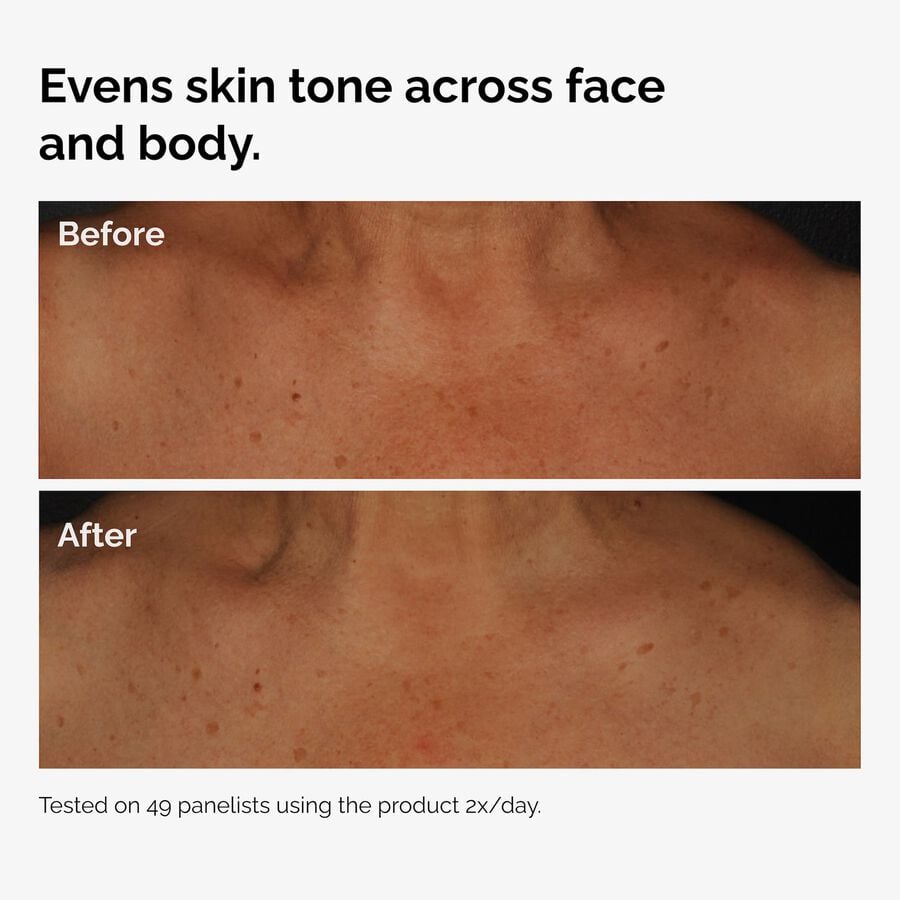 the-body-care-collection-n3 ord-niacinamide-face-body-serum-before-after-even-tone-graphic.jpg