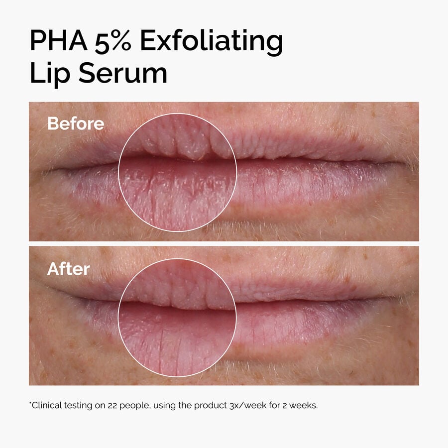pha-5-exfoliating-lip-serum-a1 ord-pha-5pct-lip-exfoliating-serum-before-after.jpg